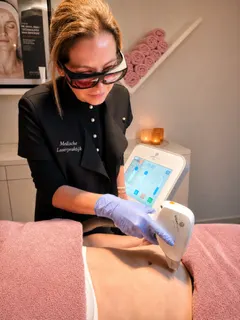 Laserontharing